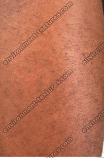 human skin hairy 0015